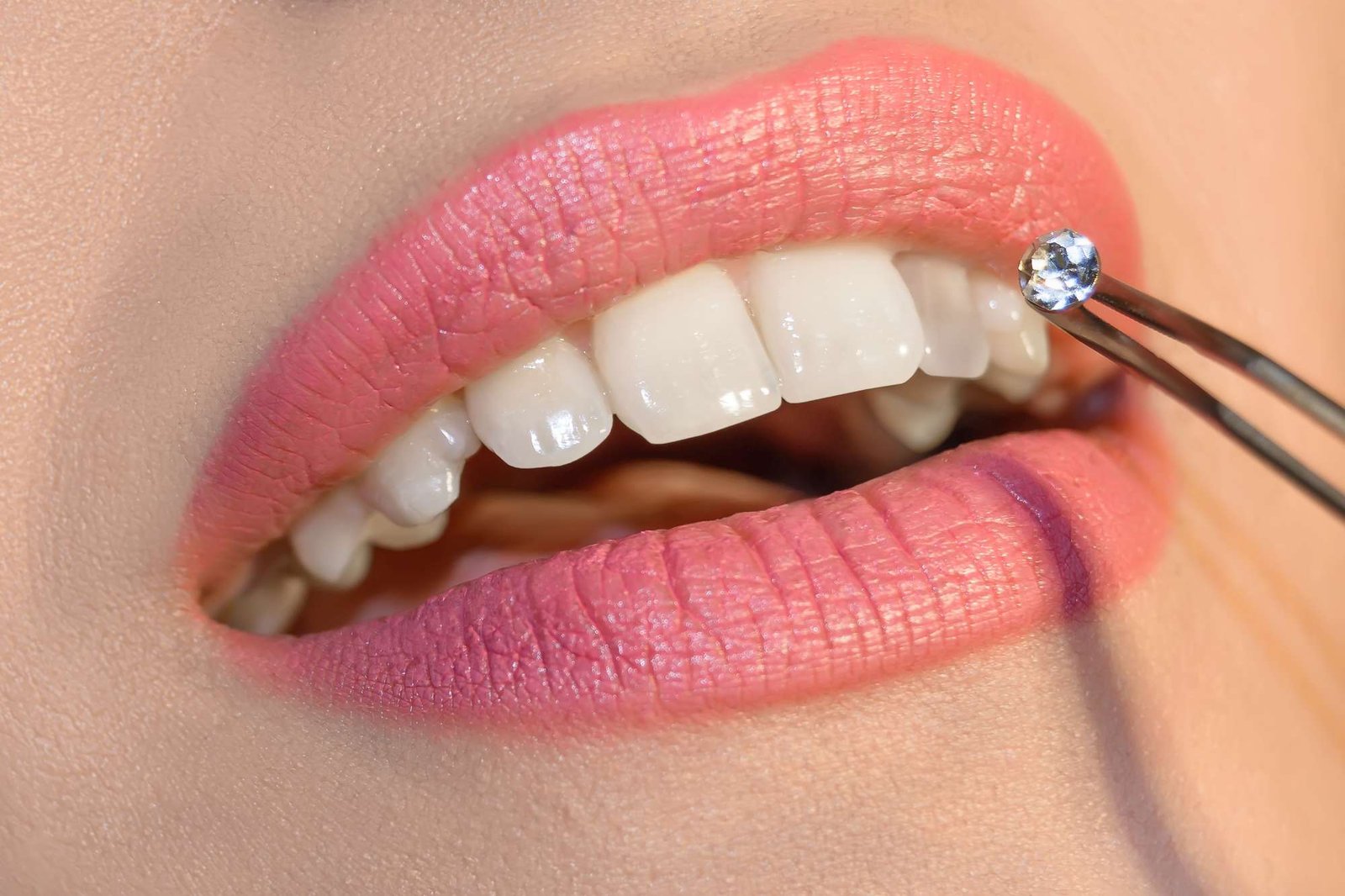 Gemme dentali